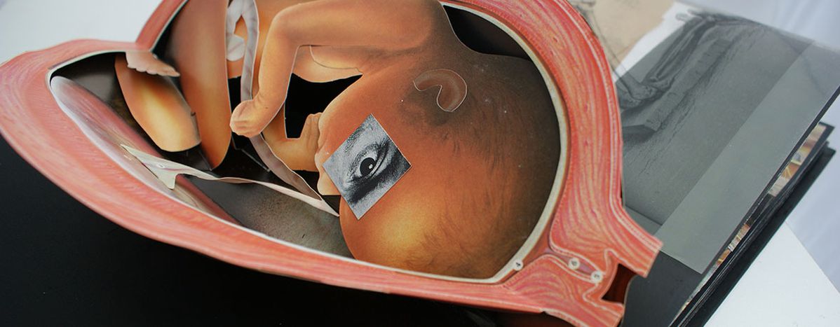 Image for L'Italia ha un serio problema con il diritto di aborto